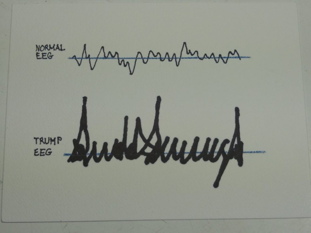Trump EKG